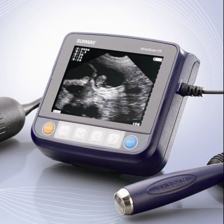 便携式兽用超声诊断仪 - Wristscan V9 - Sunway Medical - 大型动物