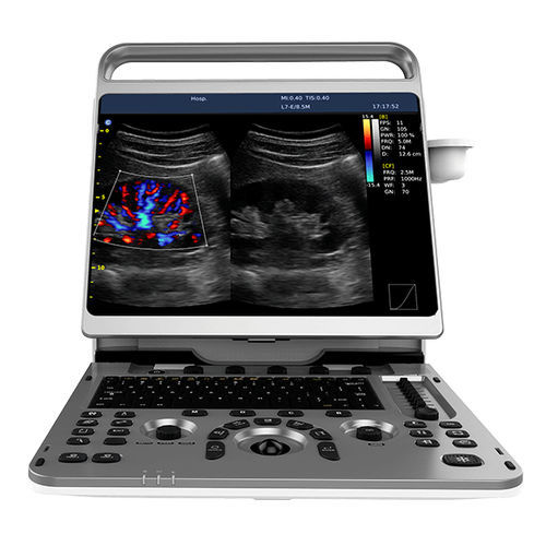 便携式、推车兽用超声诊断仪 - EBit 50  - Chison Medical Imaging - 牛 / 马科动物 / 羊用
