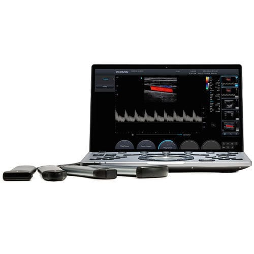 便携式兽用超声诊断仪 - SonoAir 60 - Chison Medical Imaging - 大型动物 / 农场动物 / 线性