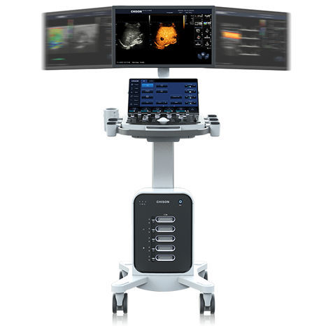 牛兽用超声诊断仪 - SonoMax 7 - Chison Medical Imaging - 便携式、推车 / 线性 / 腹部成像