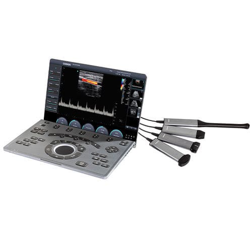 便携式兽用超声诊断仪 - SonoAir 30 - Chison Medical Imaging - 大型动物 / 农场动物 / 线性