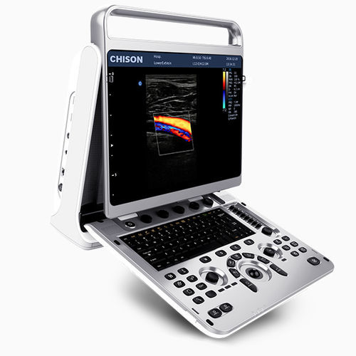 便携式兽用超声诊断仪 - EBit 10 - Chison Medical Imaging - 大型动物 / 农场动物 / 线性