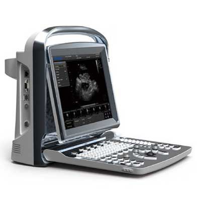 便携式兽用超声诊断仪 - Chison ECO1 Vet - Diagnostic Imaging Systems - 大型动物 / 小动物 / 用于生殖成像